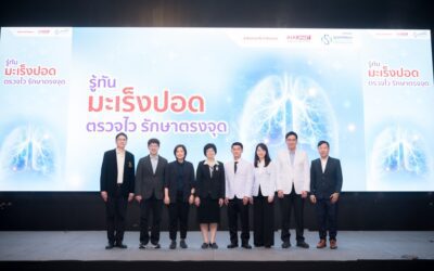 เอไอเอ จับมือ ศูนย์ศรีพัฒน์ มช. ย้ำความสำคัญของการดูแลสุขภาพเชิงป้องกัน ส่งเสริมการตรวจคัดกรองมะเร็งปอดด้วย Low-dose CT (LDCT)”